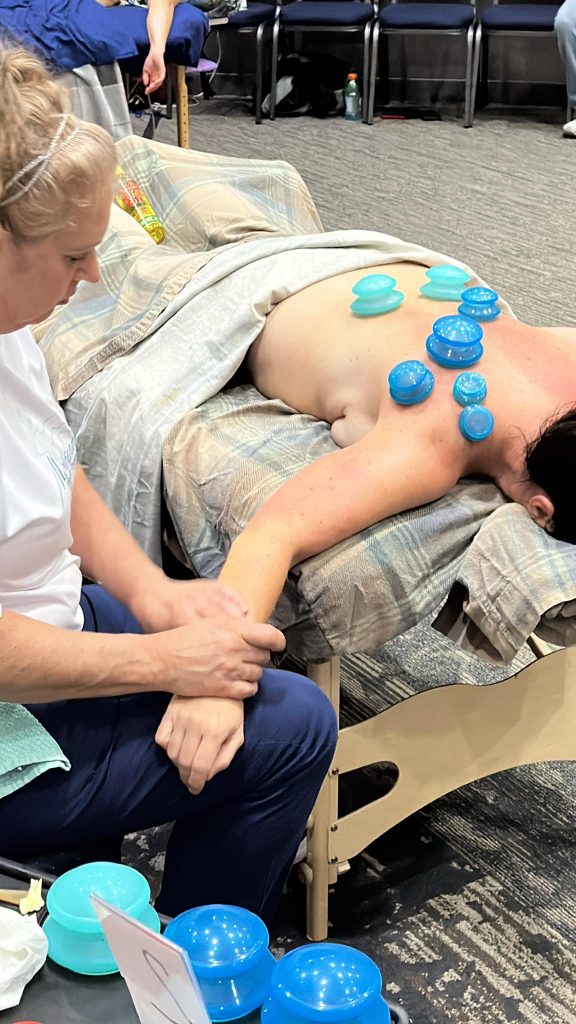 Cupping Therapy